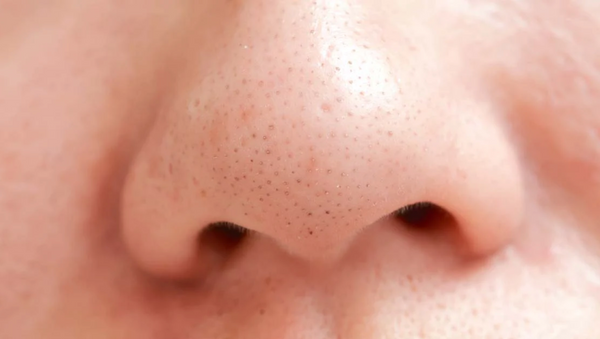 7 Ways to “Shrink” Your Nose Pores