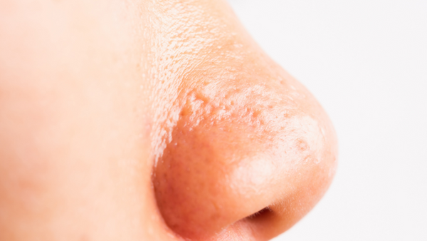 Guys, Here’s Why Your Nose Is So Oily (and 5 Tips to Fix It)