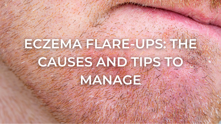 Close-up of facial skin with red, irritated eczema flare-ups and stubble hairs.