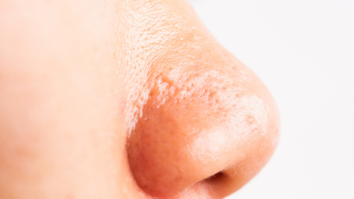 Close-up of a nose showing oily skin texture and visible pores