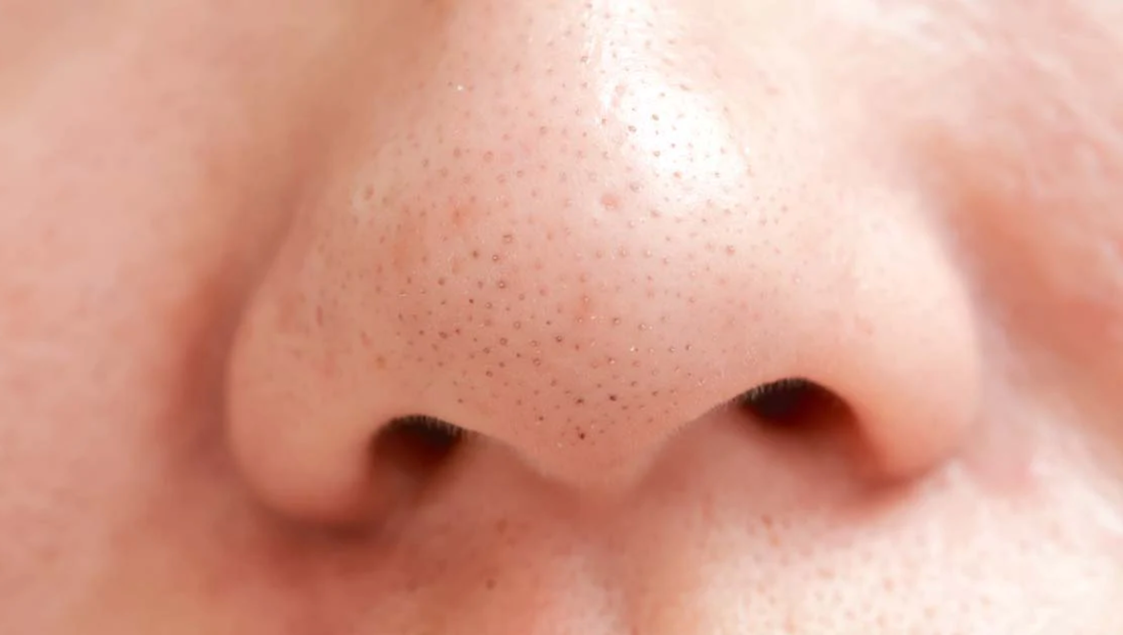 Close-up of a nose showing visible pores and blackheads on the skin surface