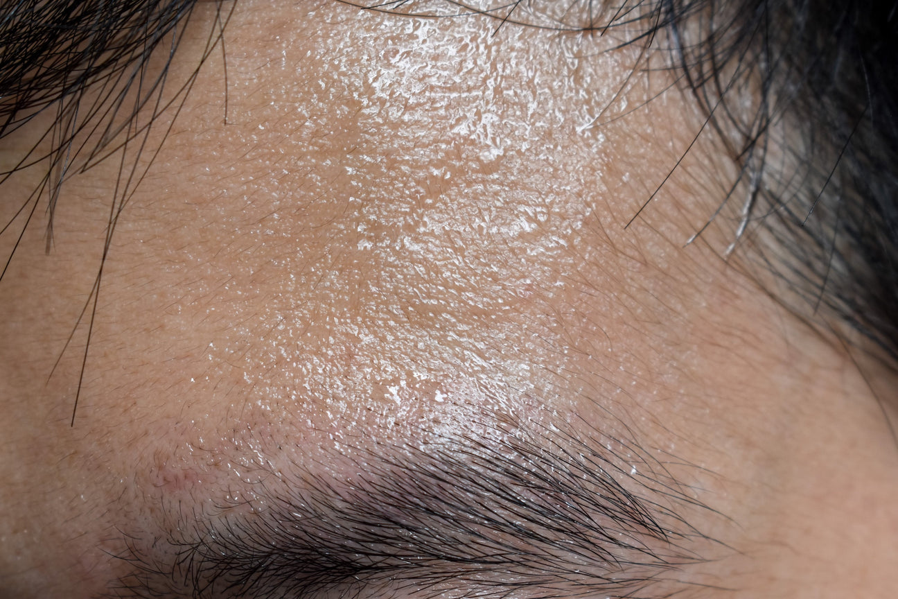 Close-up of oily skin on a forehead with visible pores and hair strands.