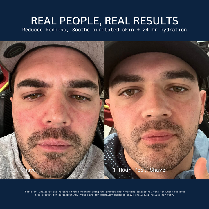 Male face before and 1 hour after shave, reduced redness; text: REAL PEOPLE, REAL RESULTS; Post Shave; 1 Hour Post Shave
