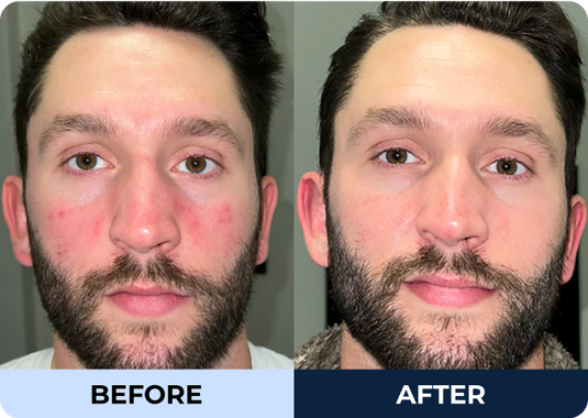 PrettyBoy | Simple Men's Skincare